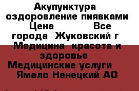 Акупунктура, оздоровление пиявками › Цена ­ 3 000 - Все города, Жуковский г. Медицина, красота и здоровье » Медицинские услуги   . Ямало-Ненецкий АО